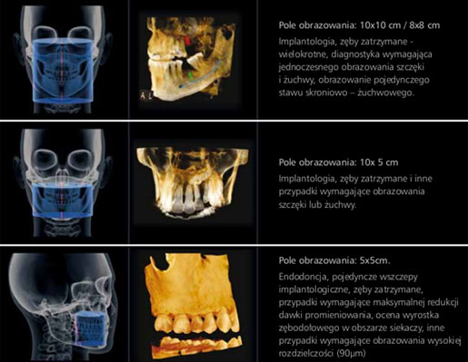 tomograf stomatologia