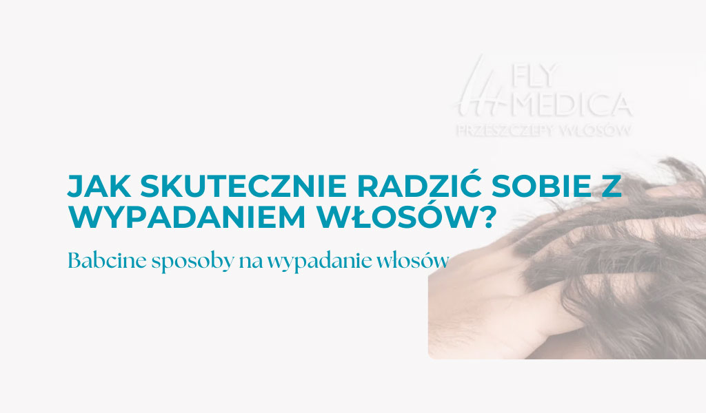 Jak skutecznie radzić sobie z wypadaniem włosów?