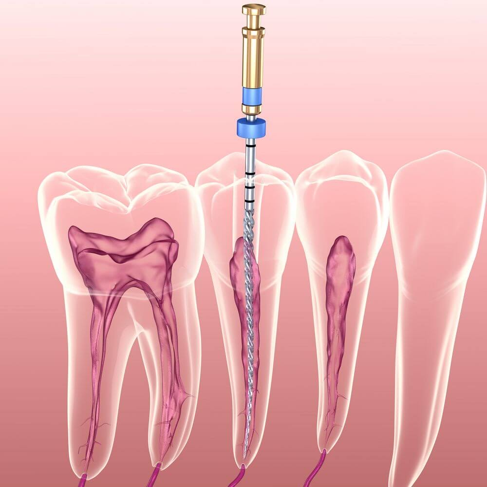 endodoncja Stomatologia